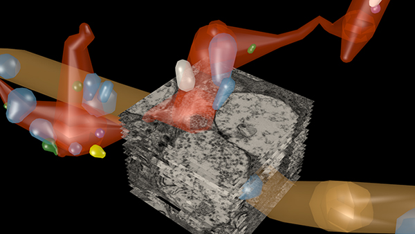 retina reconstruction