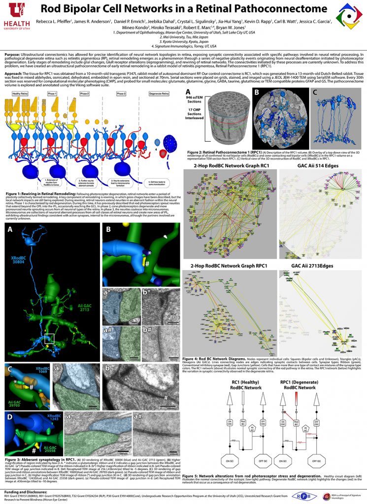 Rod Bipolar Cell Networks In A Retinal Pathoconnectome | BWJoneslab